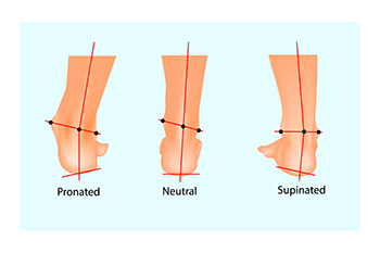 what is pronation overpronation supination, February 2020