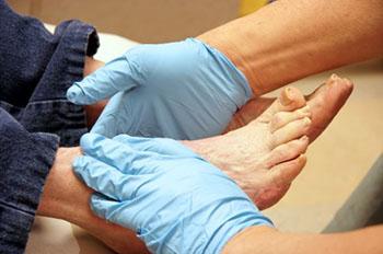 diabetic foot care in the Wayne, NJ 07470 and Caldwell, NJ 07006 areas