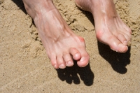 Deformity In the Toe Joints May Cause Hammertoe