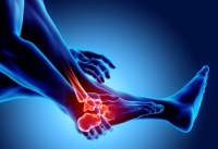 What Are the Early Symptoms of Rheumatoid Arthritis?