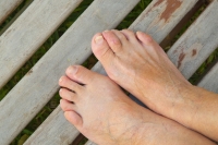 Why Do I Have Hammertoes?